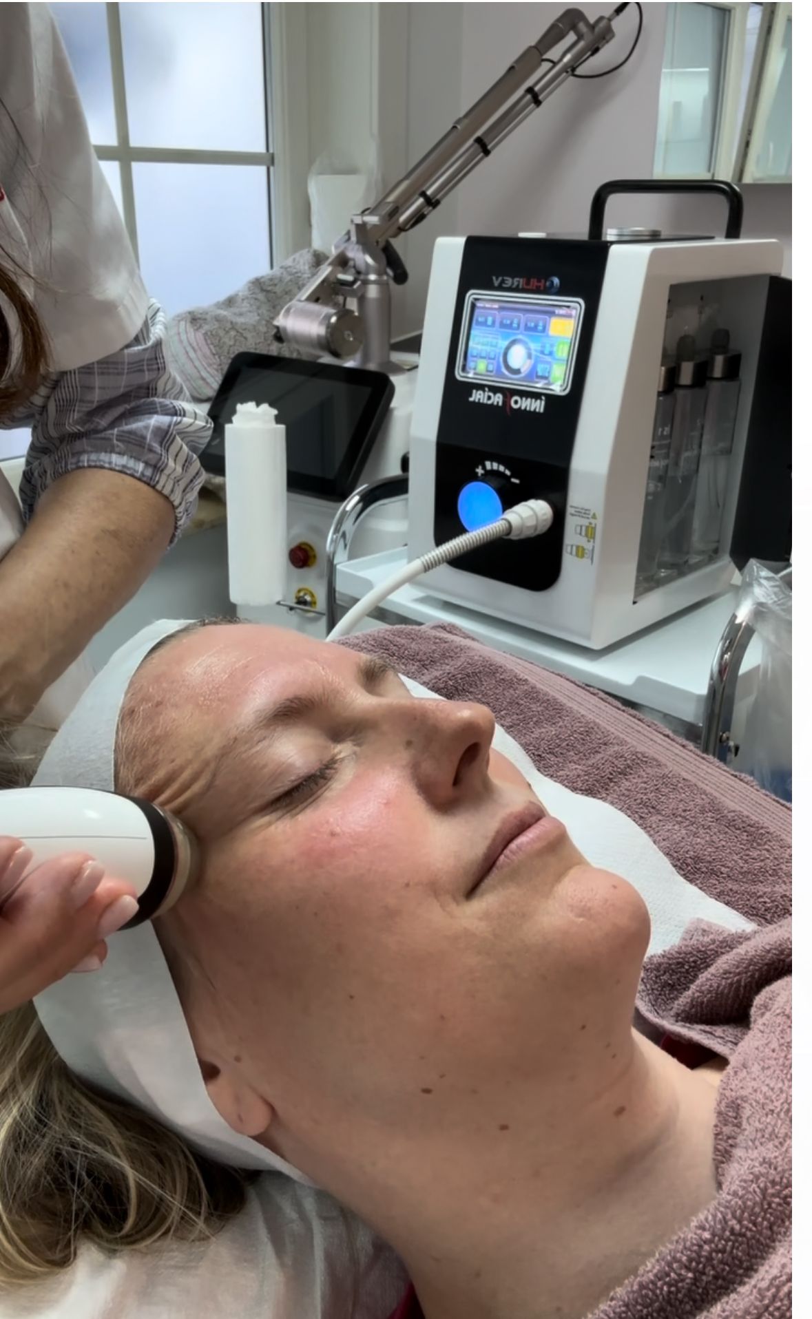 tattoo verwijderen ninove